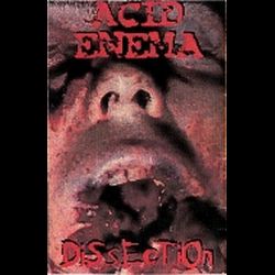 Reviews for Acid Enema - Dissection